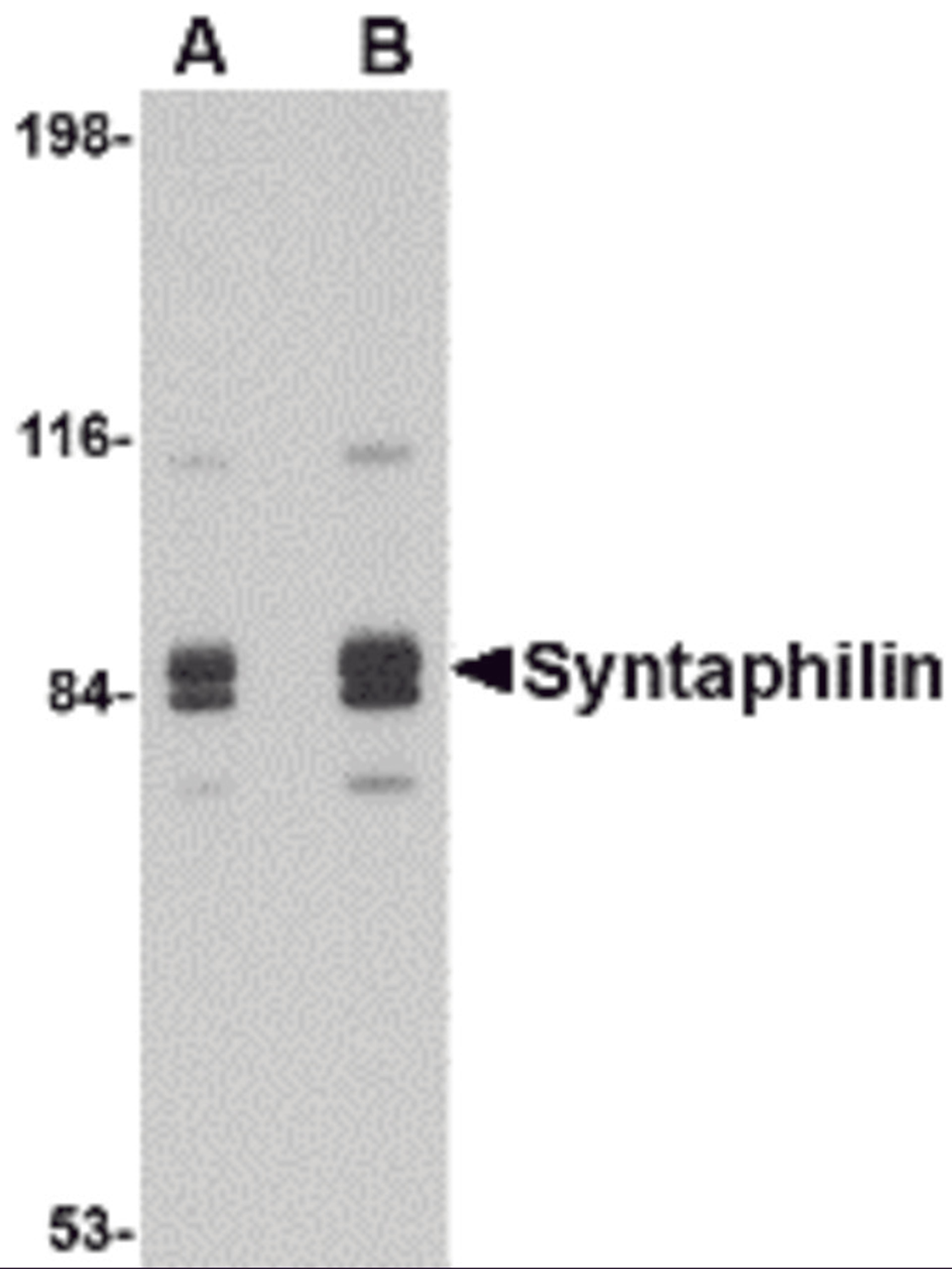 Western blot analysis of Syntaphilin in rat brain tissue lysate with Syntaphilin antibody at (A) 1 and (B) 2 μg/mL.