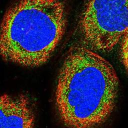 Immunofluorescence: MRPS9 Antibody [NBP2-30501] - Immunofluorescent staining of human cell line A-431 shows positivity in mitochondria.