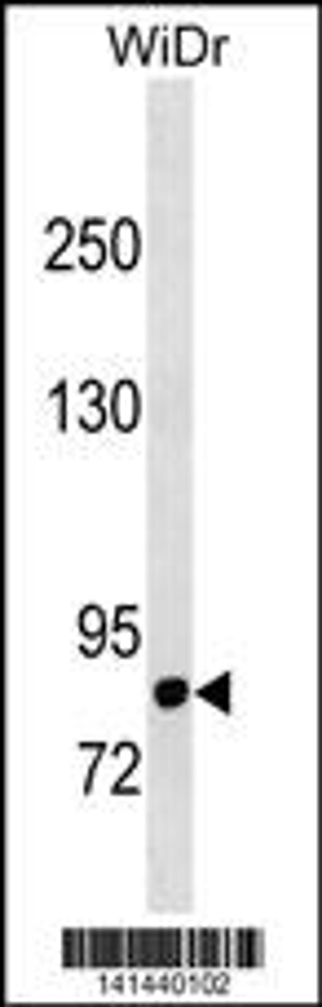 Western blot analysis in WiDr cell line lysates (35ug/lane).