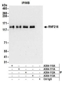 Detection of human RNF216 by western blot of immunoprecipitates.