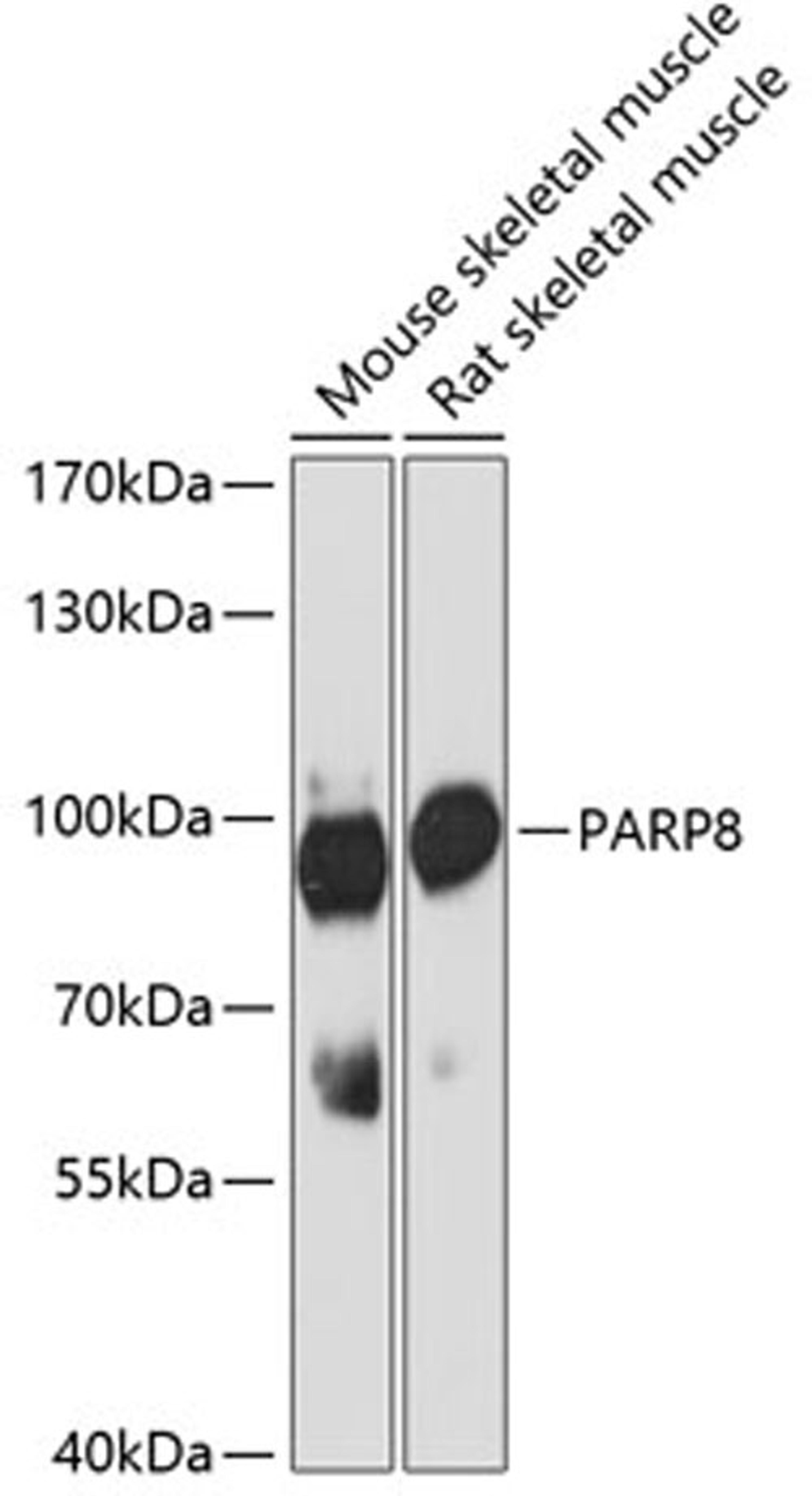 Western blot - PARP8 antibody (A12894)