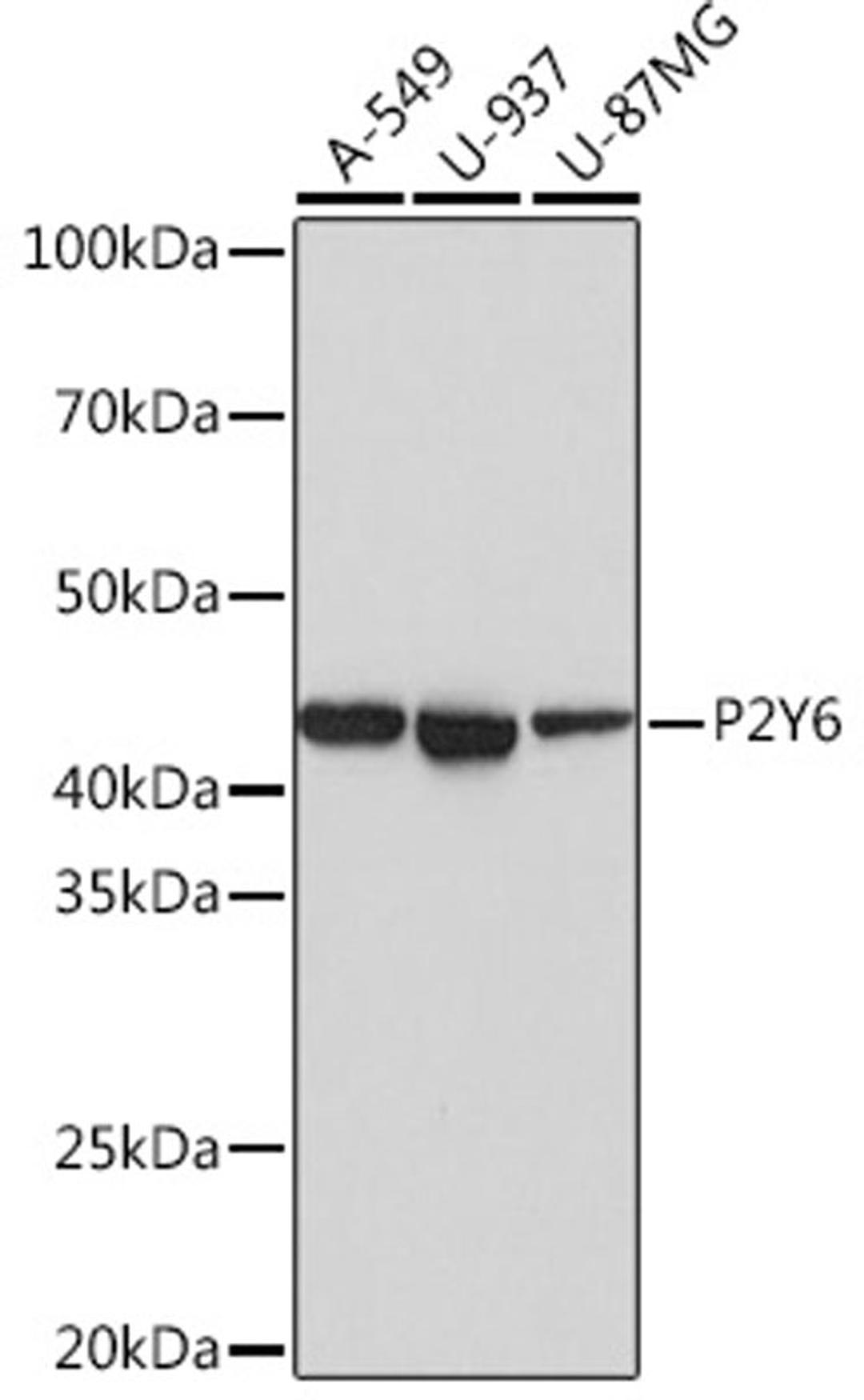Western blot - P2Y6 Rabbit mAb (A3708)