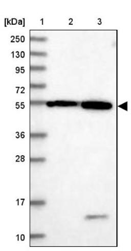 Western Blot: DEPDC4 Antibody [NBP1-90592] - Lane 1: Marker [kDa] 250, 130, 95, 72, 55, 36, 28, 17, 10<br/>Lane 2: Human cell line RT-4<br/>Lane 3: Human cell line U-251MG sp