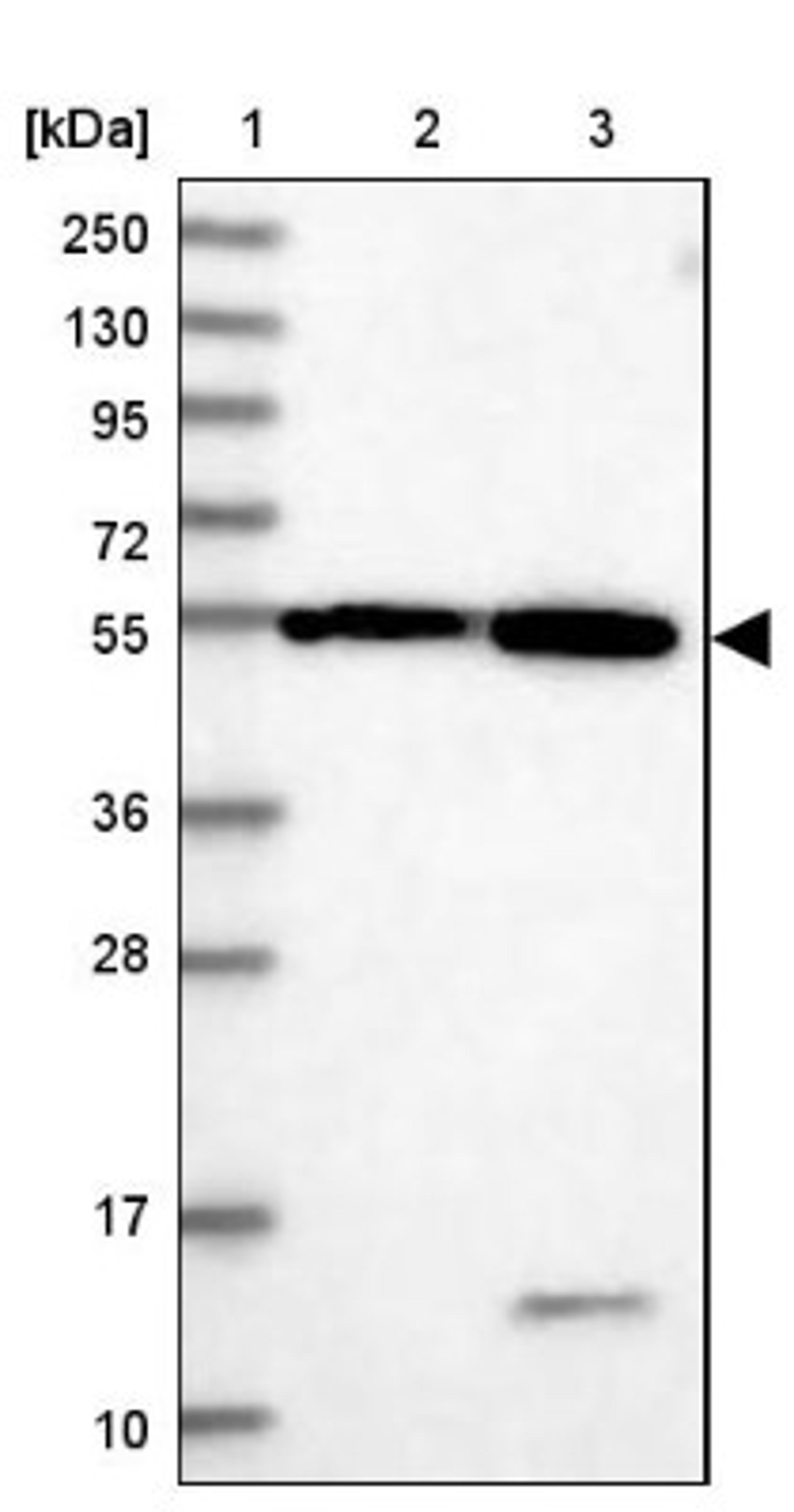 Western Blot: DEPDC4 Antibody [NBP1-90592] - Lane 1: Marker [kDa] 250, 130, 95, 72, 55, 36, 28, 17, 10<br/>Lane 2: Human cell line RT-4<br/>Lane 3: Human cell line U-251MG sp