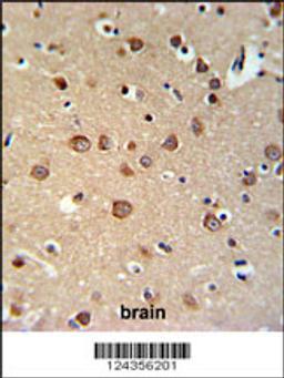 PDE6C Antibody IHC analysis in formalin fixed and paraffin embedded brain tissue followed by peroxidase conjugation of the secondary antibody and DAB staining.