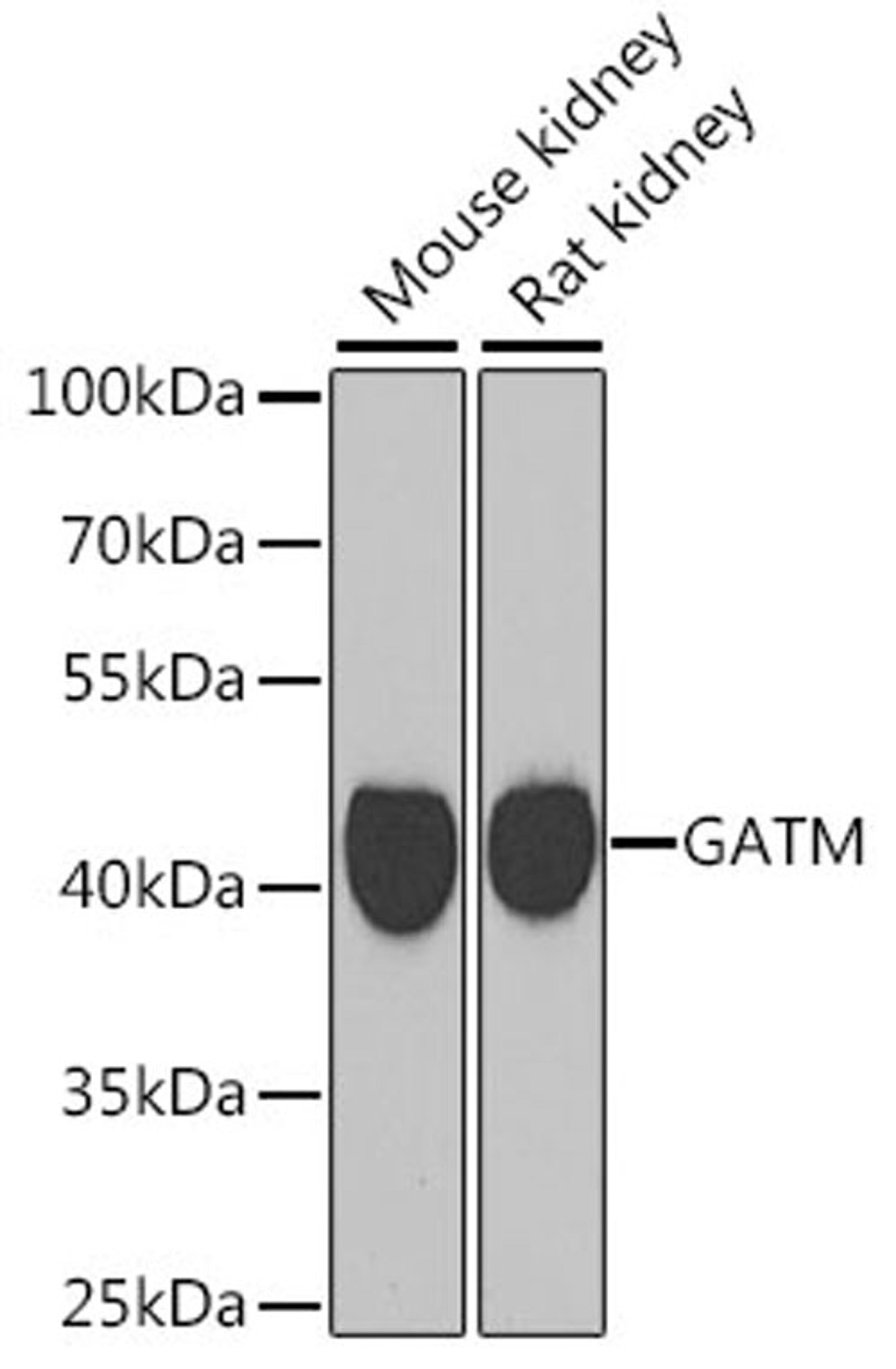 Western blot - GATM antibody (A6598)