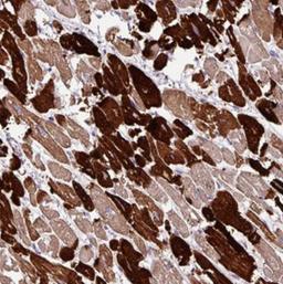 Immunohistochemistry: MYL4 Antibody [NBP2-30954] - Immunohistochemical staining of human heart muscle shows strong cytoplasmic positivity in subsets of myocytes.