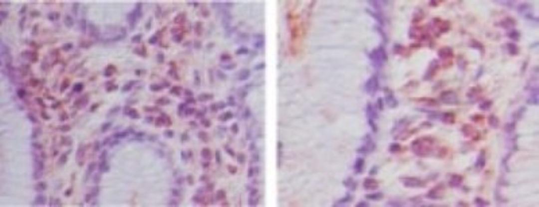 Western Blot: RNF31 Antibody [NBP2-27290] - Analysis of RNF31 (HOIP) using RNF31 antibody. Human rectum probed with RNF31 antibody at 5 ug/ml.