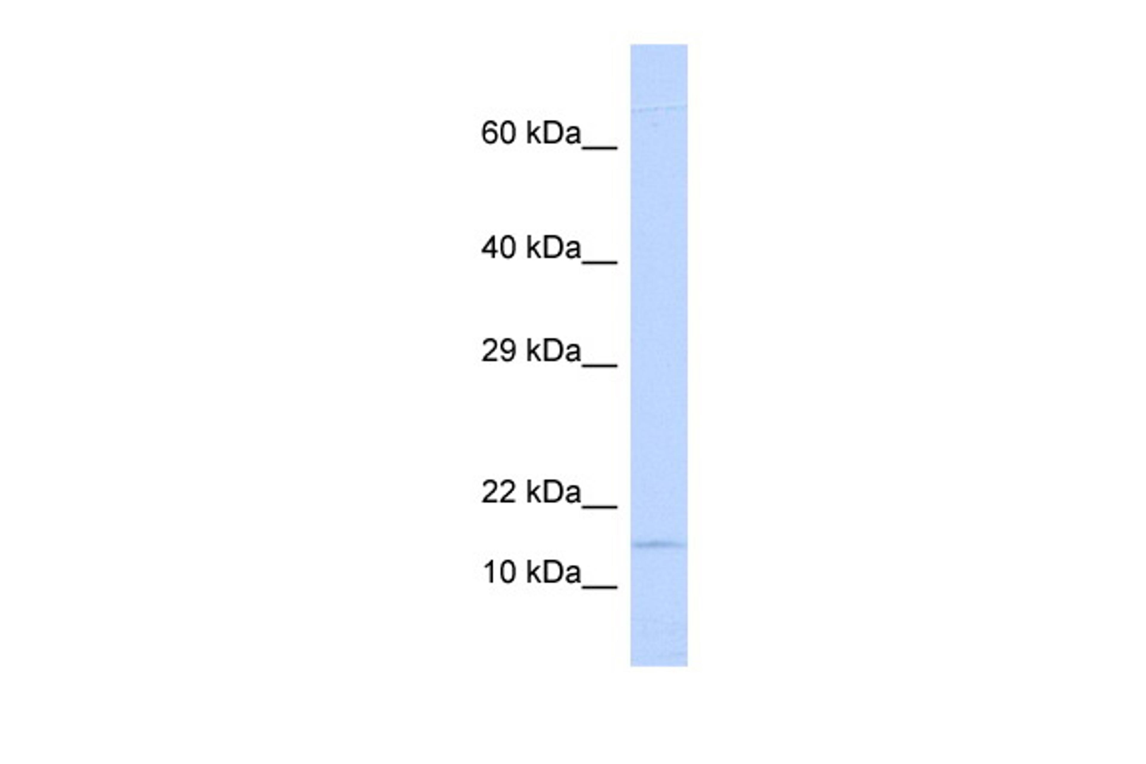 Antibody used in WB on Human Lung at 0.2-1 ug/ml.