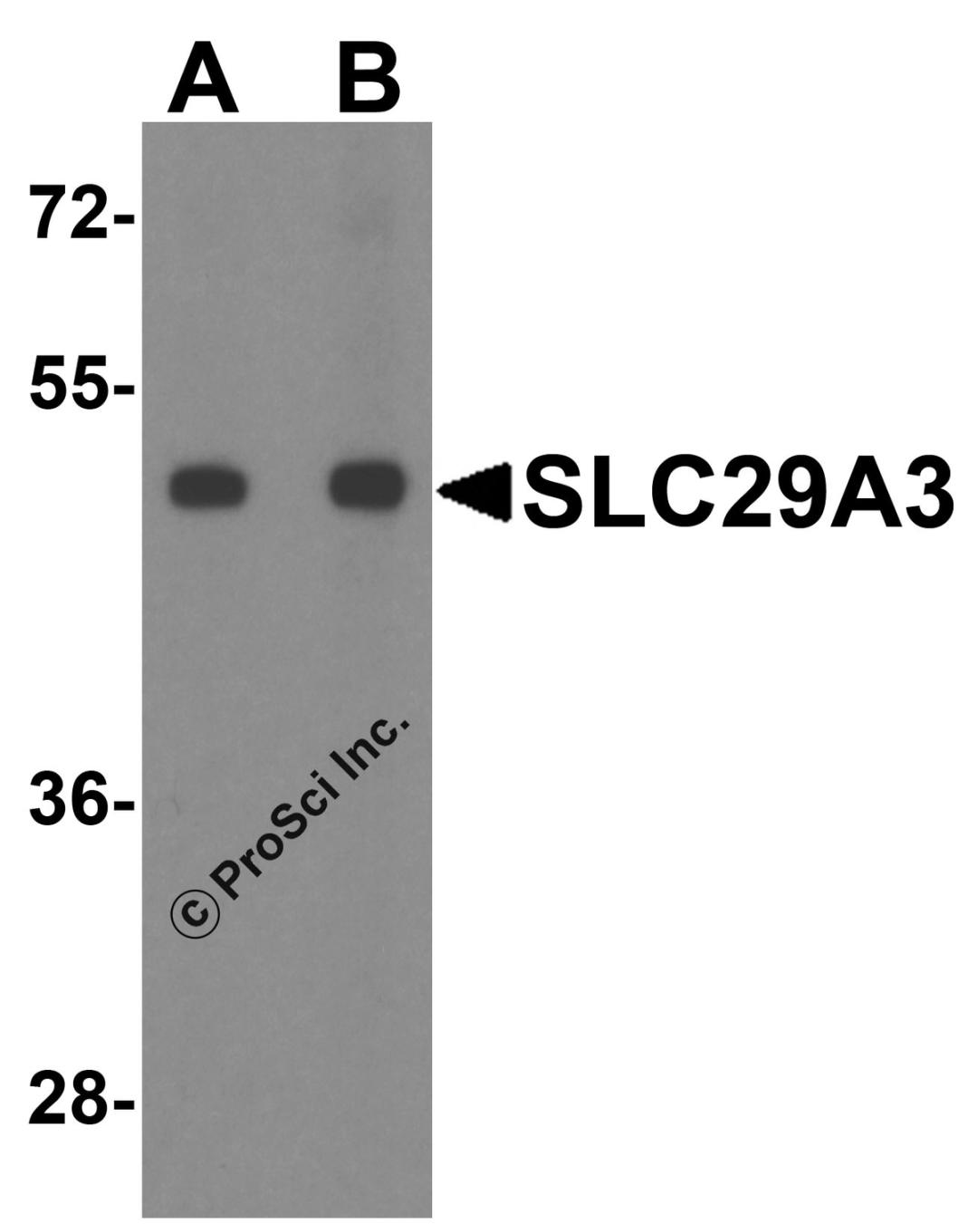 Western blot analysis of SLC29A3 in mouse bladder tissue lysate with SLC29A3 antibody at (A) 1 and (B) 2 &#956;g/ml.