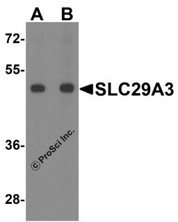 Western blot analysis of SLC29A3 in mouse bladder tissue lysate with SLC29A3 antibody at (A) 1 and (B) 2 μg/ml.