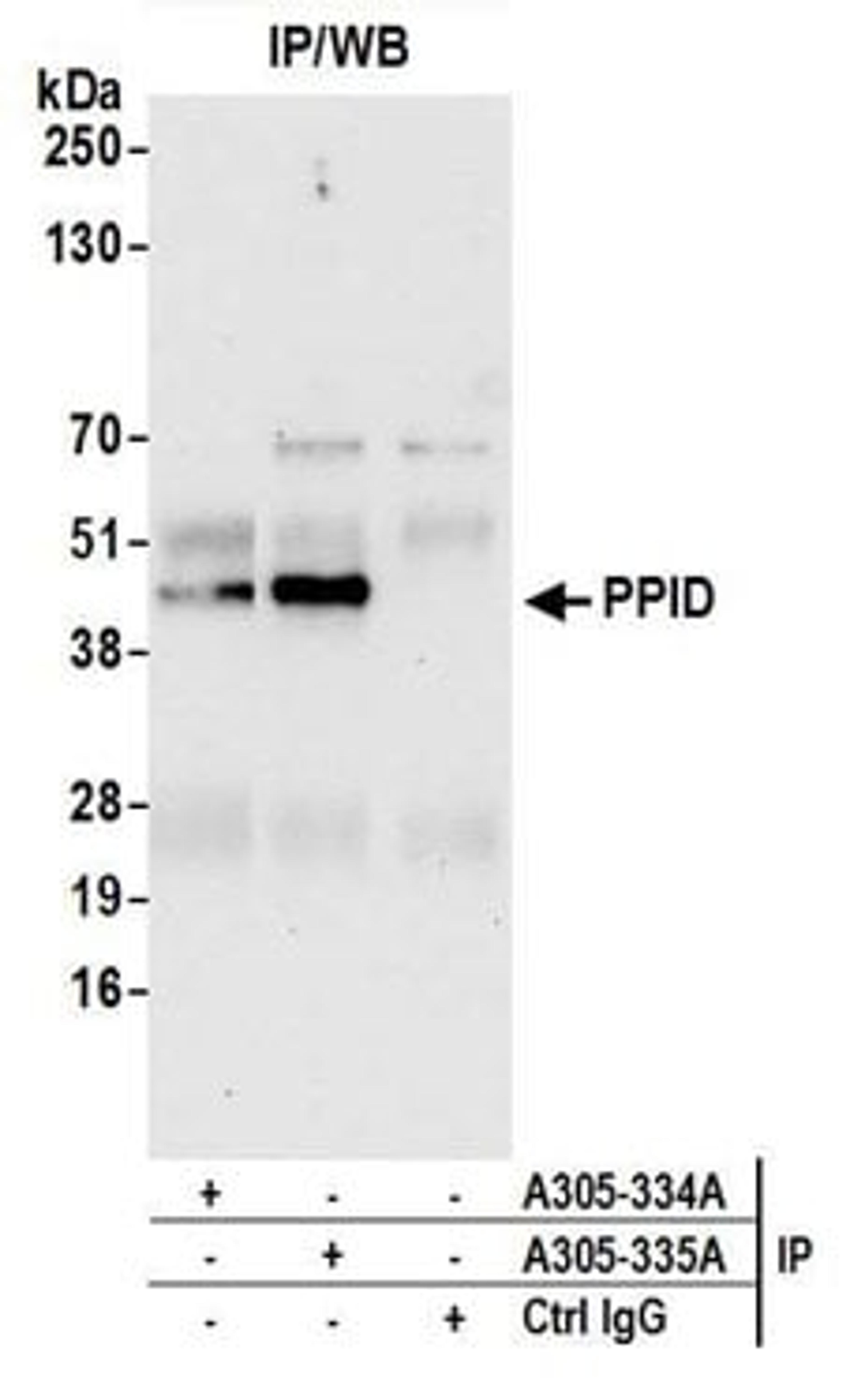 Detection of human PPID by western blot of immunoprecipitates.