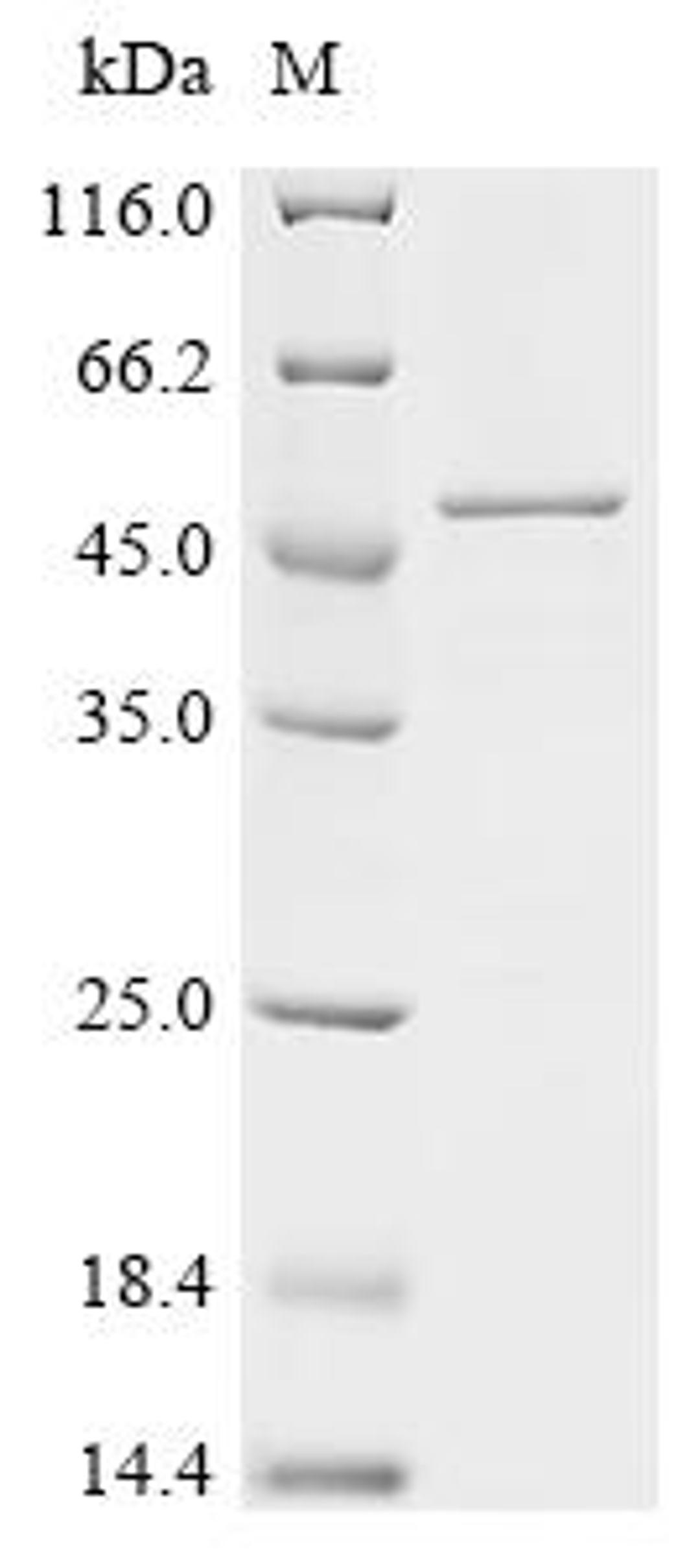 (Tris-Glycine gel) Discontinuous SDS-PAGE (reduced) with 5% enrichment gel and 15% separation gel.