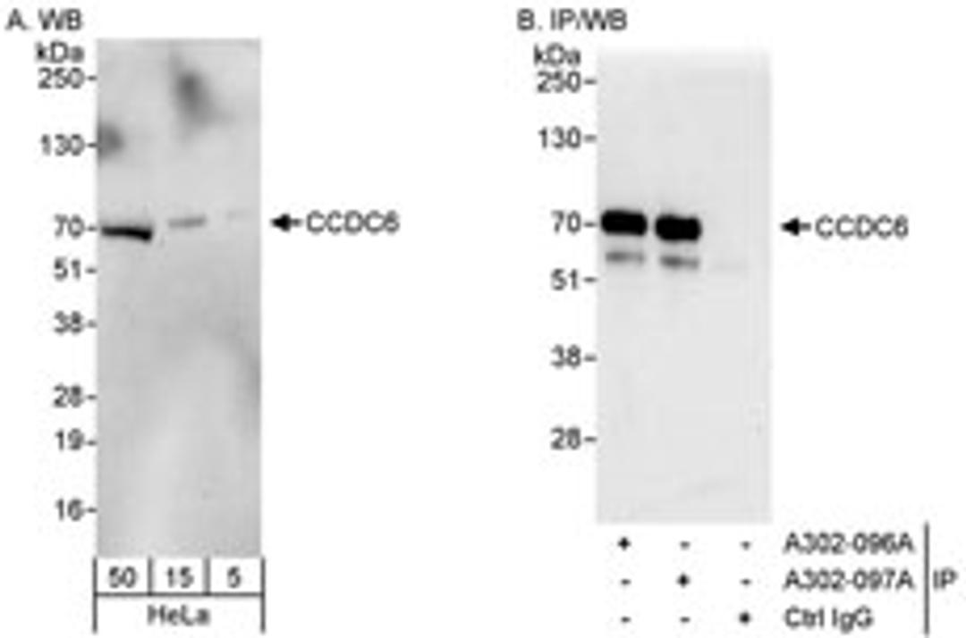 Detection of human CCDC6 by western blot and immunoprecipitation.