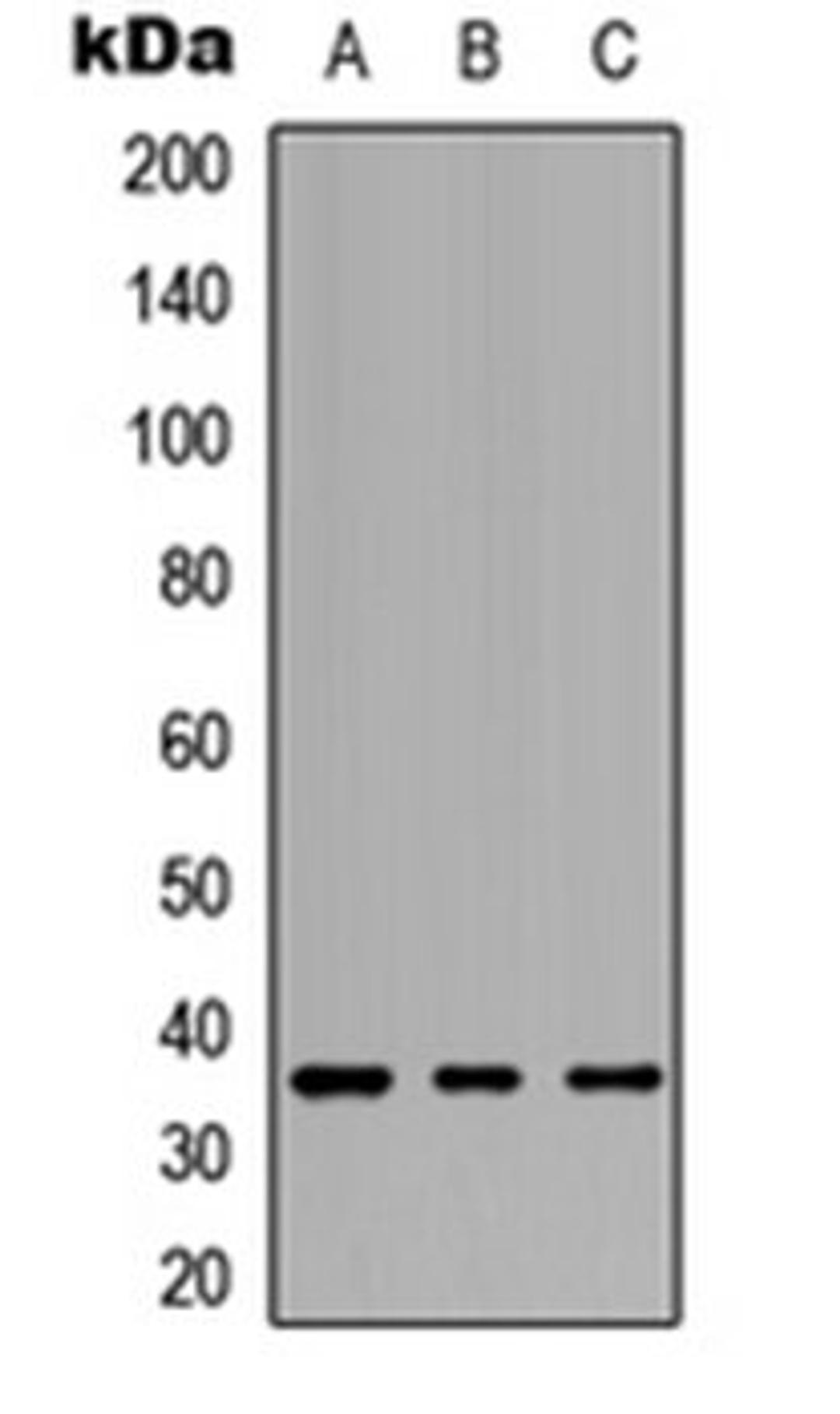 Western blot analysis of HEK293T (Lane 1), Raw264.7 (Lane 2), PC12 (Lane 3) whole cell lysates using GPCR19 antibody