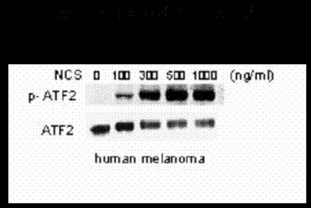 Western blot of human melanoma cells incubated with varying doses of the radiometric drug NCS showing phospho-specific immunolabeling of the ATF2 protein phosphorylated at Ser 490,498.