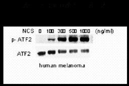 Western blot of human melanoma cells incubated with varying doses of the radiometric drug NCS showing phospho-specific immunolabeling of the ATF2 protein phosphorylated at Ser 490,498.