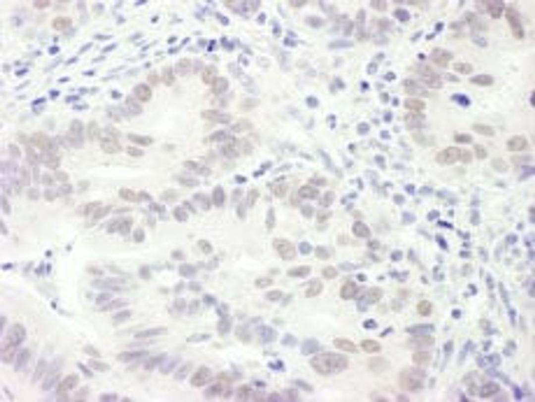 Detection of human EDD1 by immunohistochemistry.