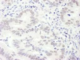 Detection of human EDD1 by immunohistochemistry.