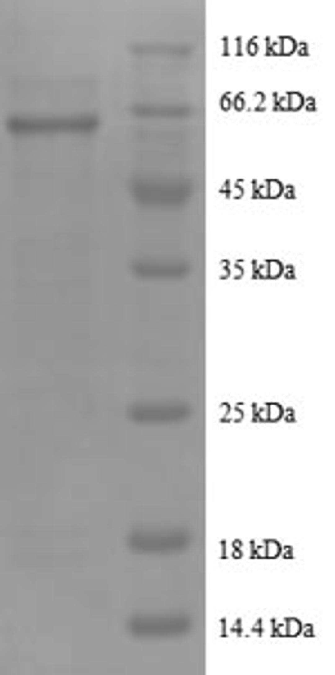 (Tris-Glycine gel) Discontinuous SDS-PAGE (reduced) with 5% enrichment gel and 15% separation gel.