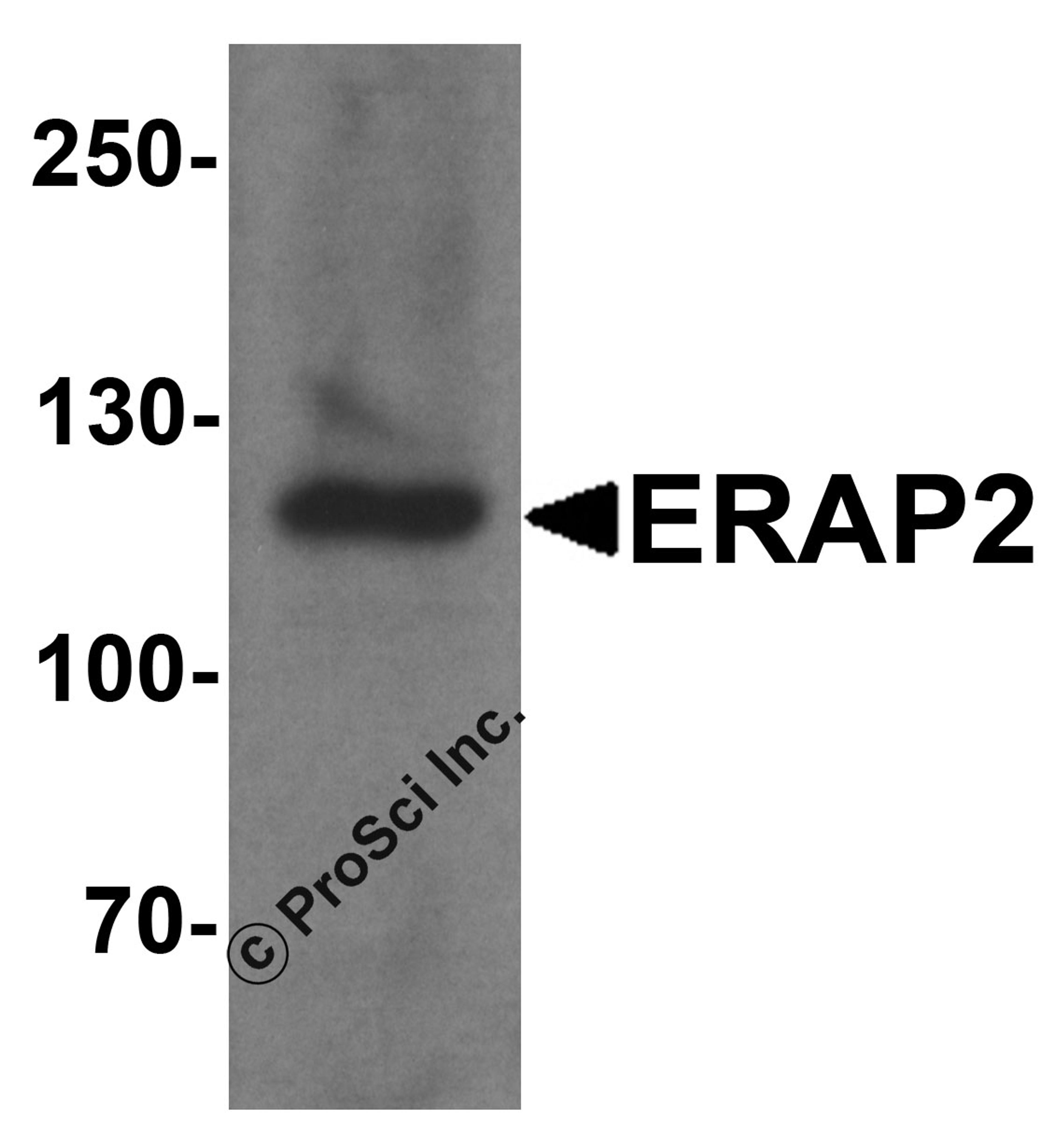 Western blot analysis of ERAP2 in human ovary tissue lysate with ERAP2 antibody at 1 μg/ml.