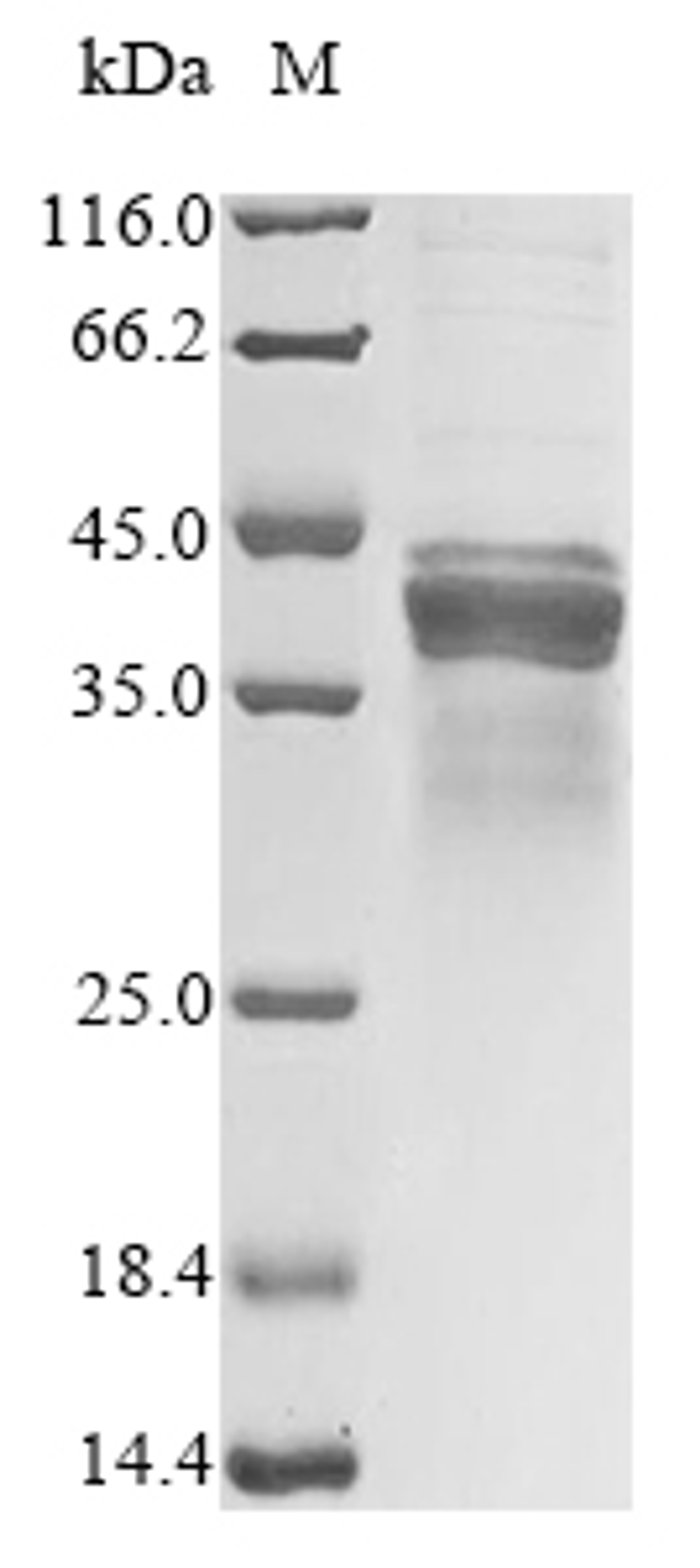 (Tris-Glycine gel) Discontinuous SDS-PAGE (reduced) with 5% enrichment gel and 15% separation gel.