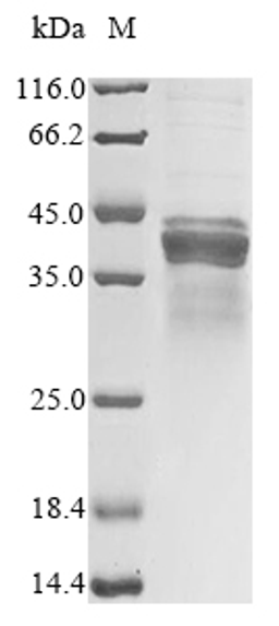 (Tris-Glycine gel) Discontinuous SDS-PAGE (reduced) with 5% enrichment gel and 15% separation gel.