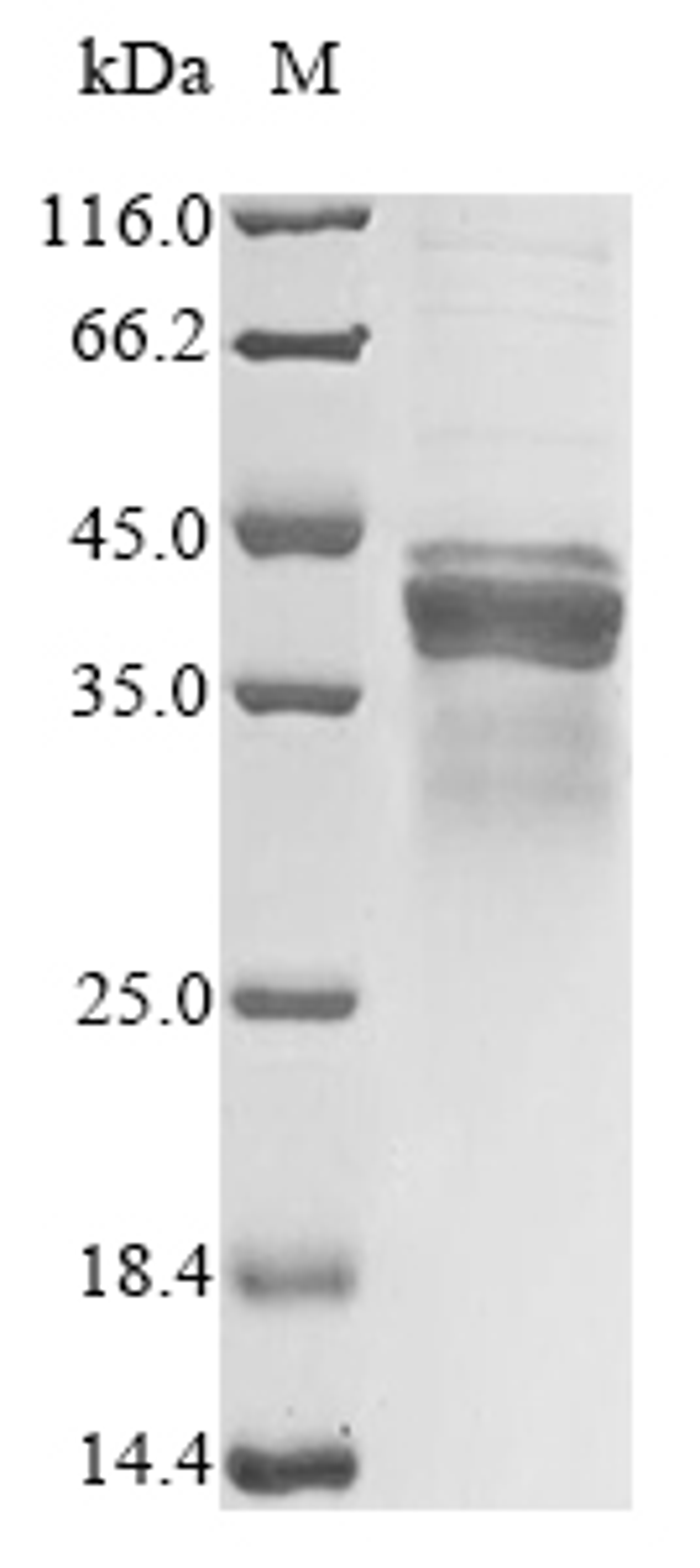 (Tris-Glycine gel) Discontinuous SDS-PAGE (reduced) with 5% enrichment gel and 15% separation gel.