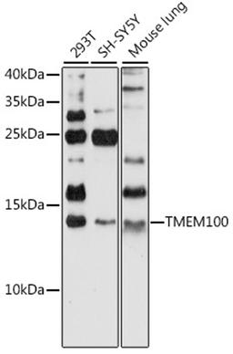 Western blot - TMEM100 antibody (A16653)