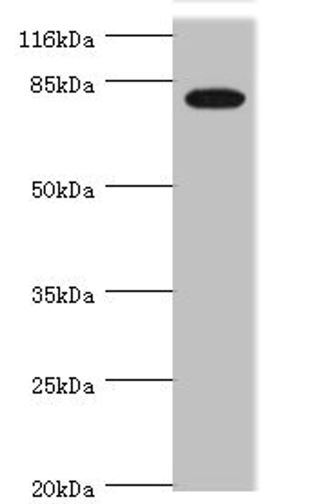 Western blot. All lanes: IL31RA antibody at 1.45ug/ml + Mouse kidney tissue. Secondary. Goat polyclonal to rabbit IgG at 1/10000 dilution. Predicted band size: 83, 87, 75, 42, 78, 71, 59, 67, 64, 70, 85 kDa. Observed band size: 83 kDa. 