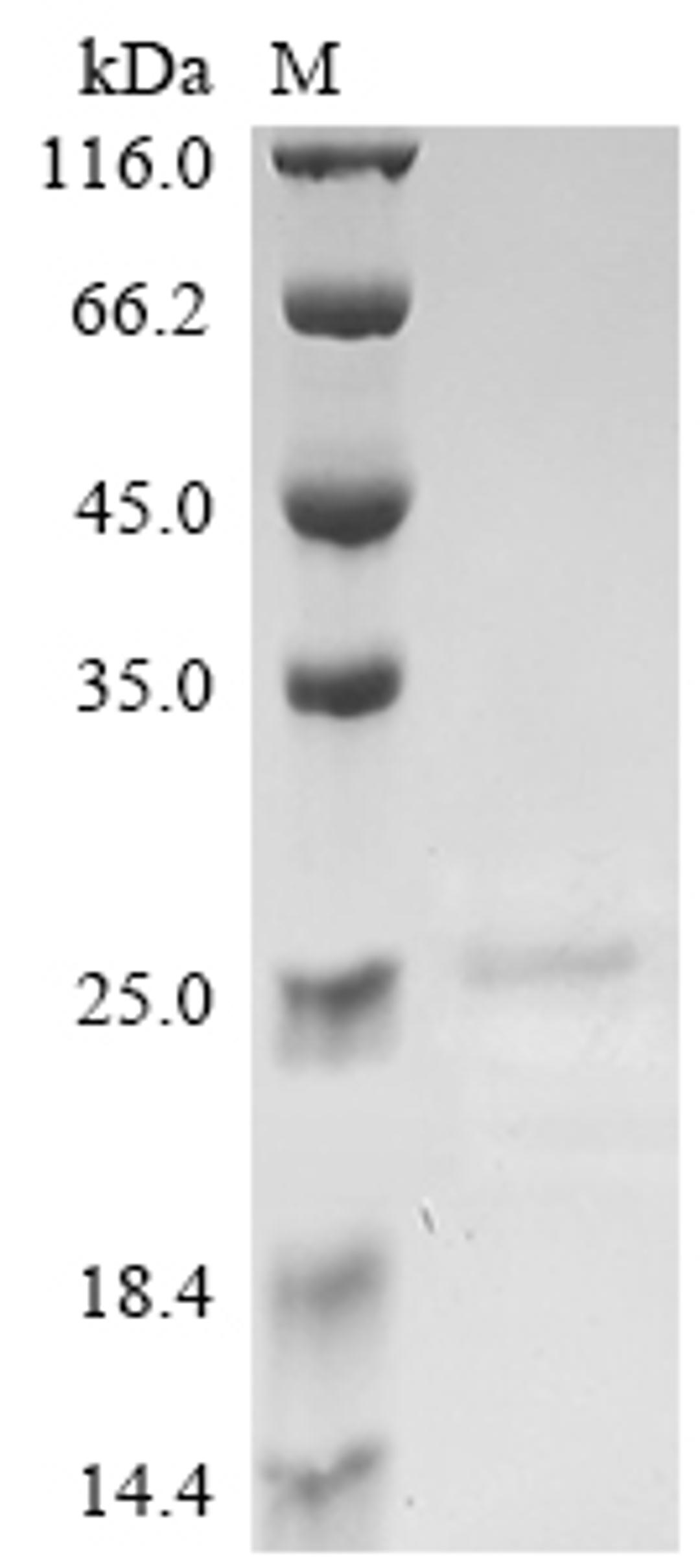(Tris-Glycine gel) Discontinuous SDS-PAGE (reduced) with 5% enrichment gel and 15% separation gel.