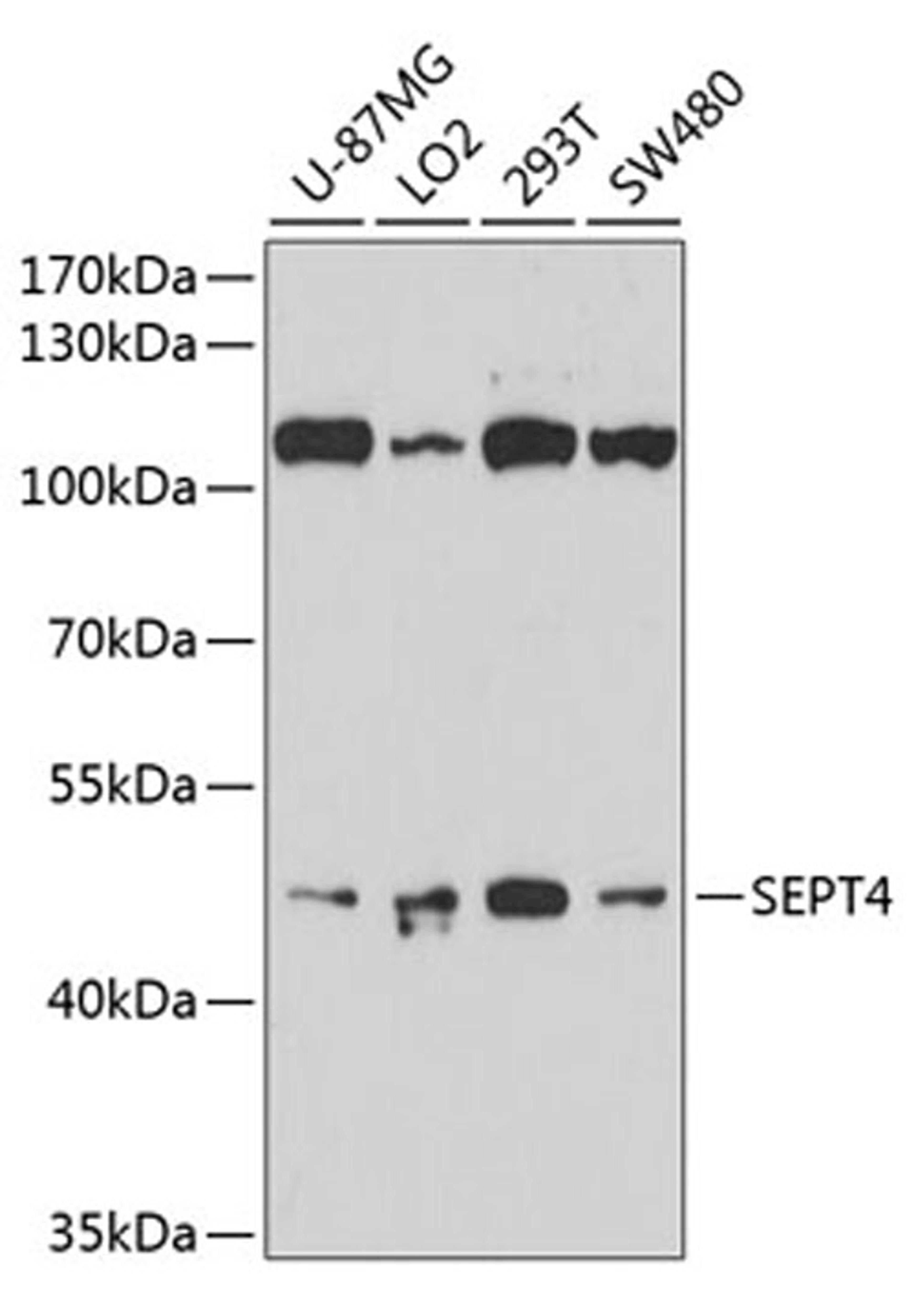 Western blot - SEPT4 antibody (A10238)