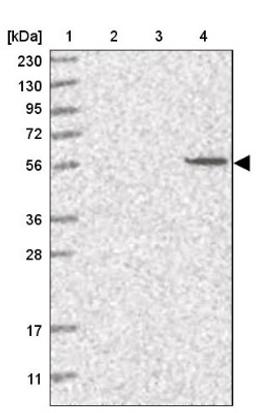 Western Blot: SLC43A3 Antibody [NBP1-85026] - Lane 1: Marker [kDa] 230, 130, 95, 72, 56, 36, 28, 17, 11<br/>Lane 2: Human cell line RT-4<br/>Lane 3: Human cell line U-251MG sp<br/>Lane 4: Human plasma (IgG/HSA depleted)