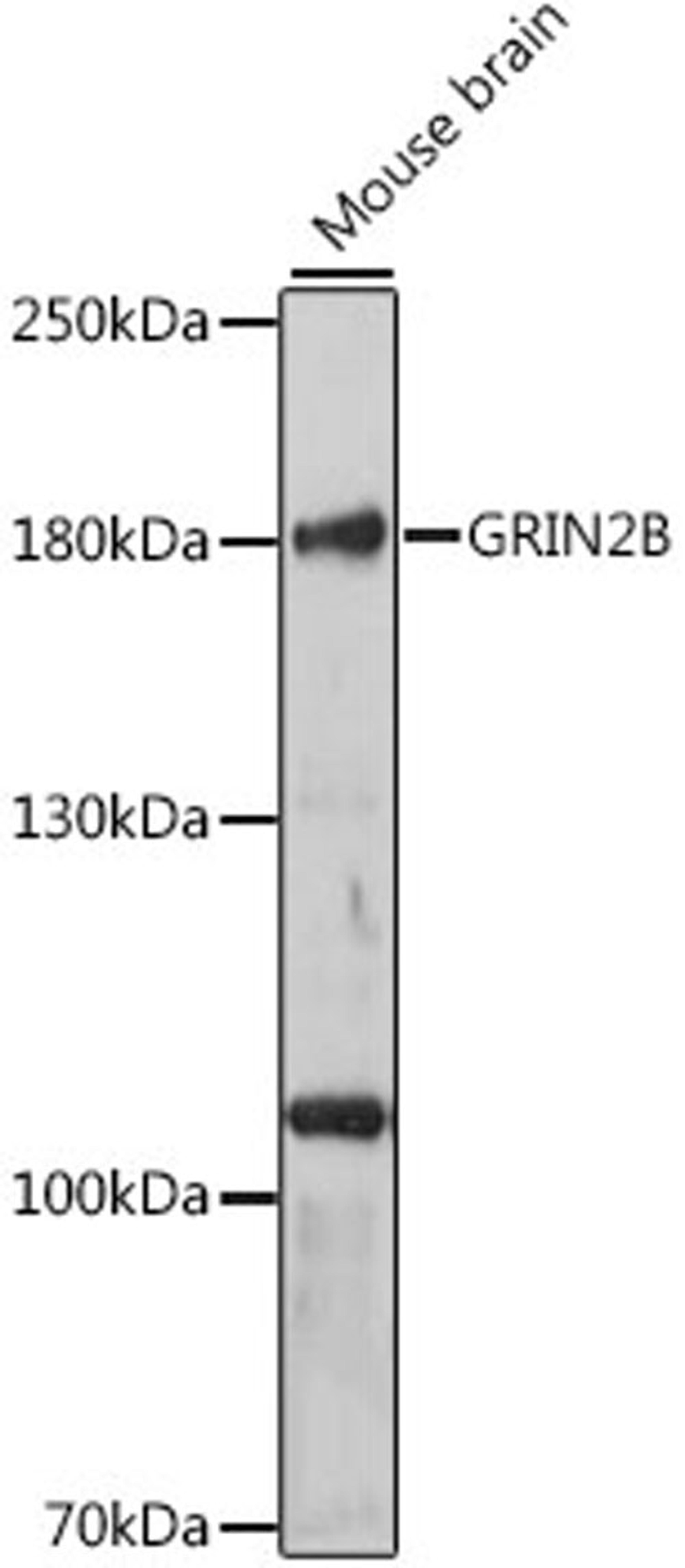 Western blot - GRIN2B antibody (A3056)