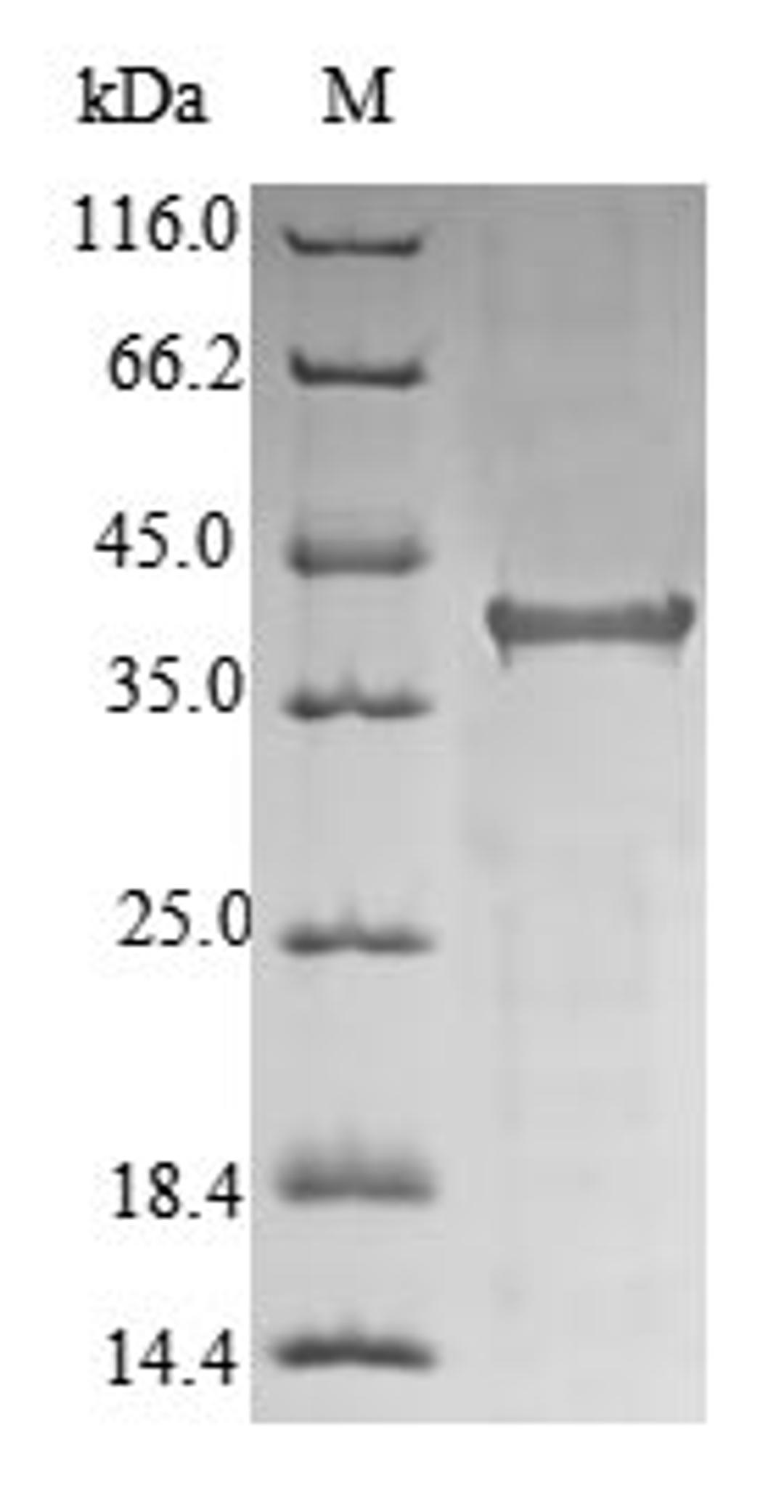 (Tris-Glycine gel) Discontinuous SDS-PAGE (reduced) with 5% enrichment gel and 15% separation gel.