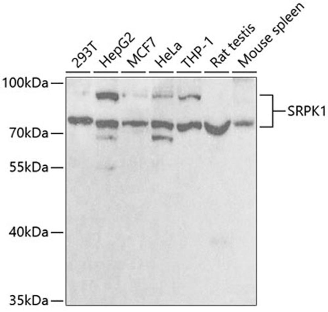 Western blot - SRPK1 antibody (A5854)