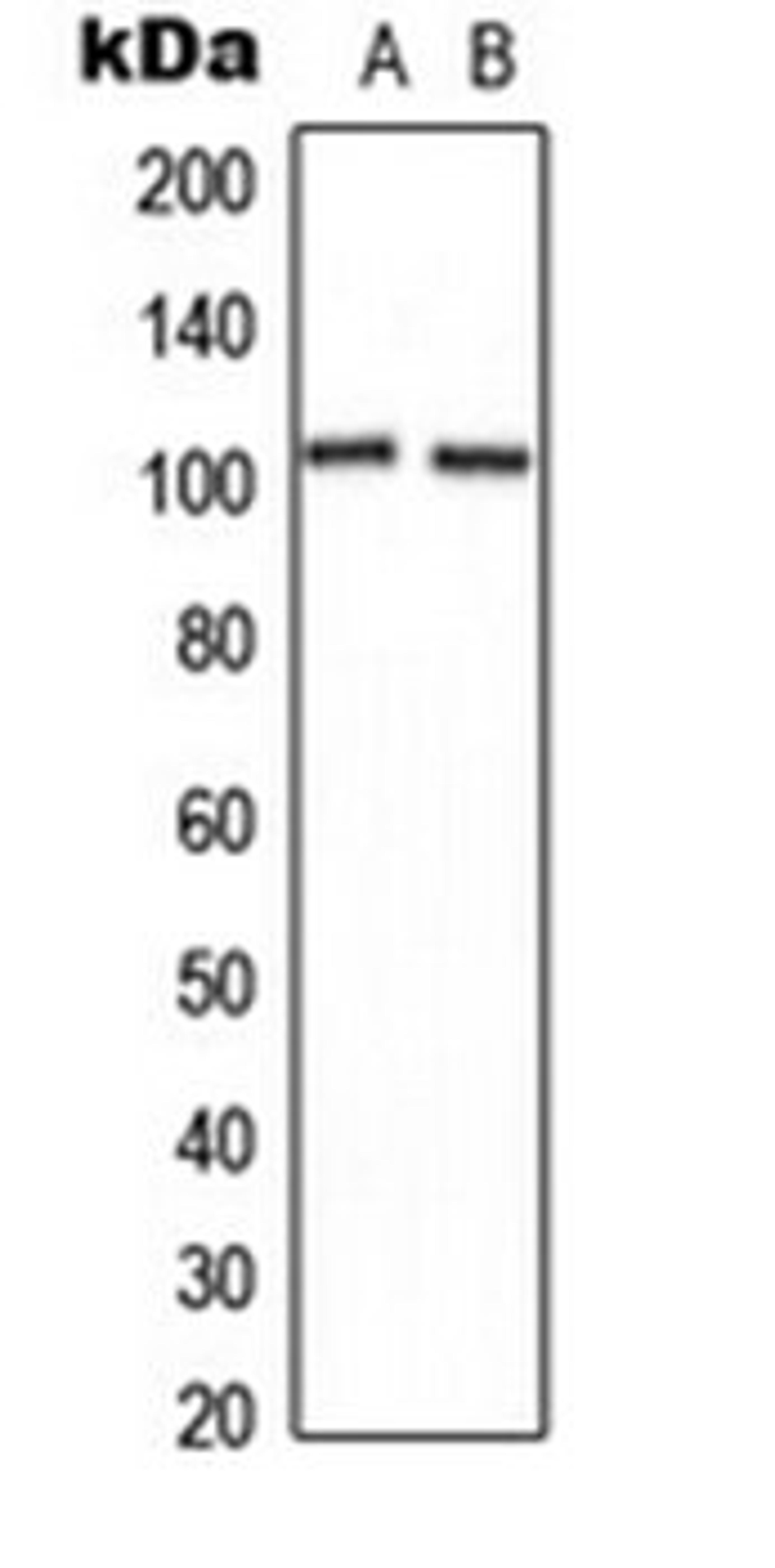 Western blot analysis of U2OS (Lane 1), NIH3T3 (Lane 2) whole cell lysates using CNGB1 antibody