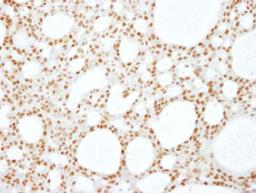 Detection of human RBM16 by immunohistochemistry.