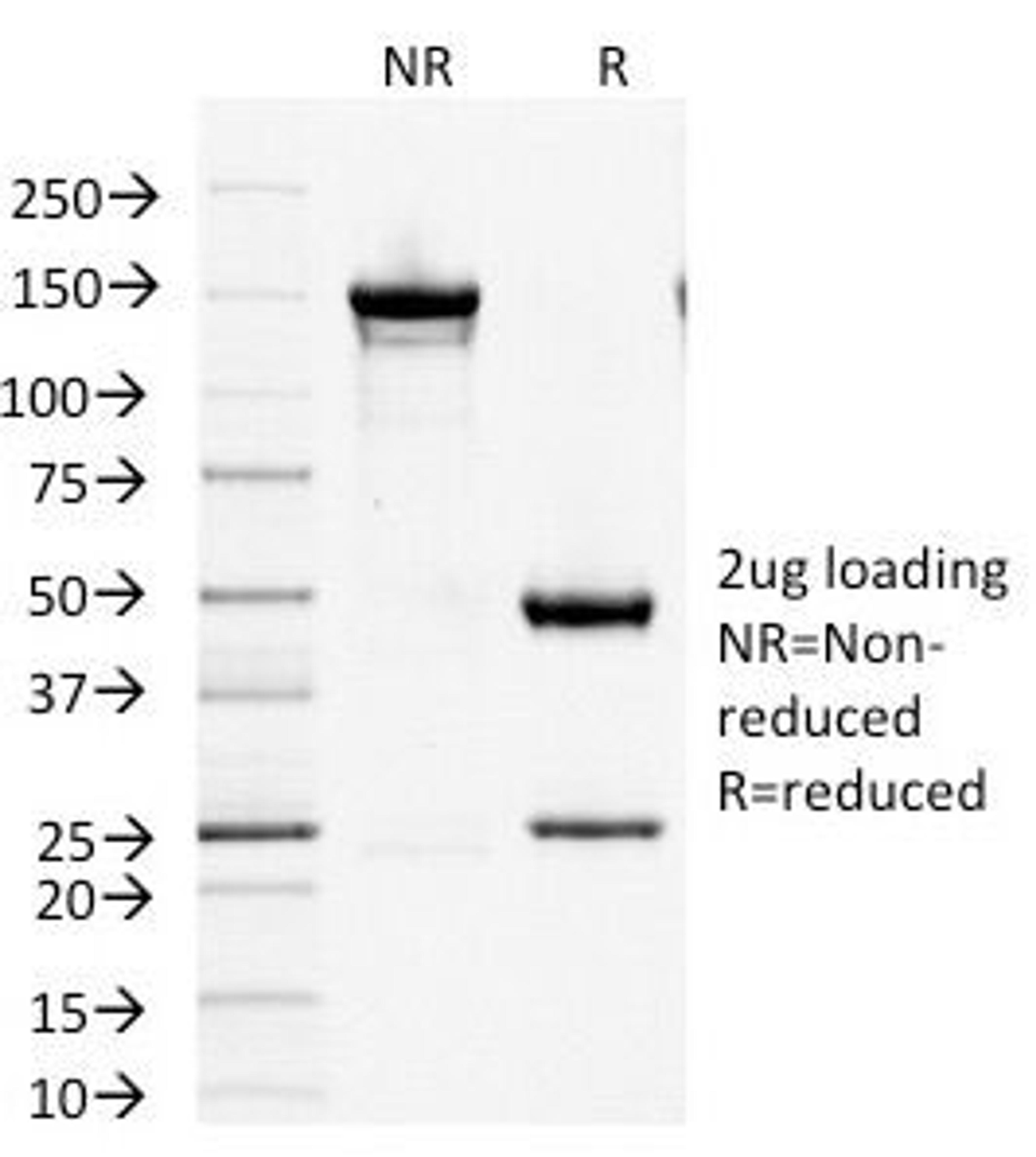 SDS-PAGE Analysis of Purified, BSA-Free Factor XIIIa Antibody (clone F13A1/1447). Confirmation of Integrity and Purity of the Antibody.