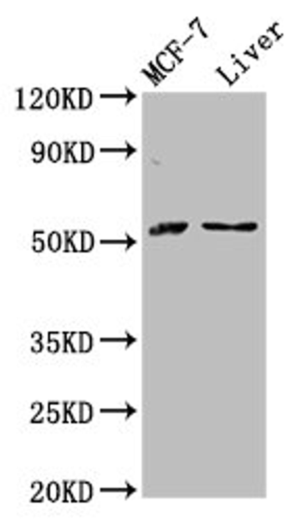 Western Blot. Positive WB detected in: MCF-7 whole cell lysate, Rat liver tissue. All lanes: AKT2 antibody at 2.8µg/ml. Secondary. Goat polyclonal to rabbit IgG at 1/50000 dilution. Predicted band size: 56, 52 kDa. Observed band size: 56 kDa