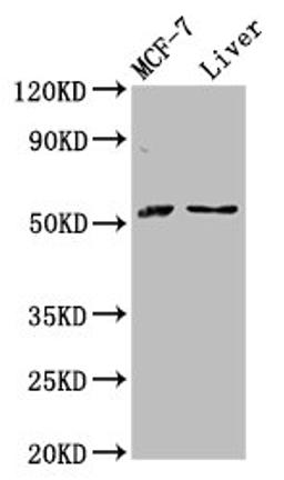 Western Blot. Positive WB detected in: MCF-7 whole cell lysate, Rat liver tissue. All lanes: AKT2 antibody at 2.8µg/ml. Secondary. Goat polyclonal to rabbit IgG at 1/50000 dilution. Predicted band size: 56, 52 kDa. Observed band size: 56 kDa