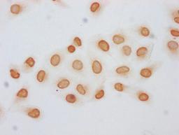 Immunocytochemistry analysis of CSB-PA010403OA120acHU diluted at 1:5 and staining in Hela cells (treated with 30mM sodium butyrate for 4h) performed on a Leica BondTM system. The cells were fixed in 4% formaldehyde, permeabilized using 0.2% Triton X-100 and blocked with 10% normal goat serum 30min at RT. Then primary antibody (1% BSA) was incubated at 4°C overnight. The primary is detected by a biotinylated secondary antibody and visualized using an HRP conjugated SP system.