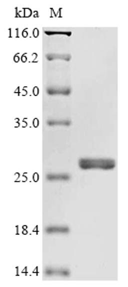(Tris-Glycine gel) Discontinuous SDS-PAGE (reduced) with 5% enrichment gel and 15% separation gel.