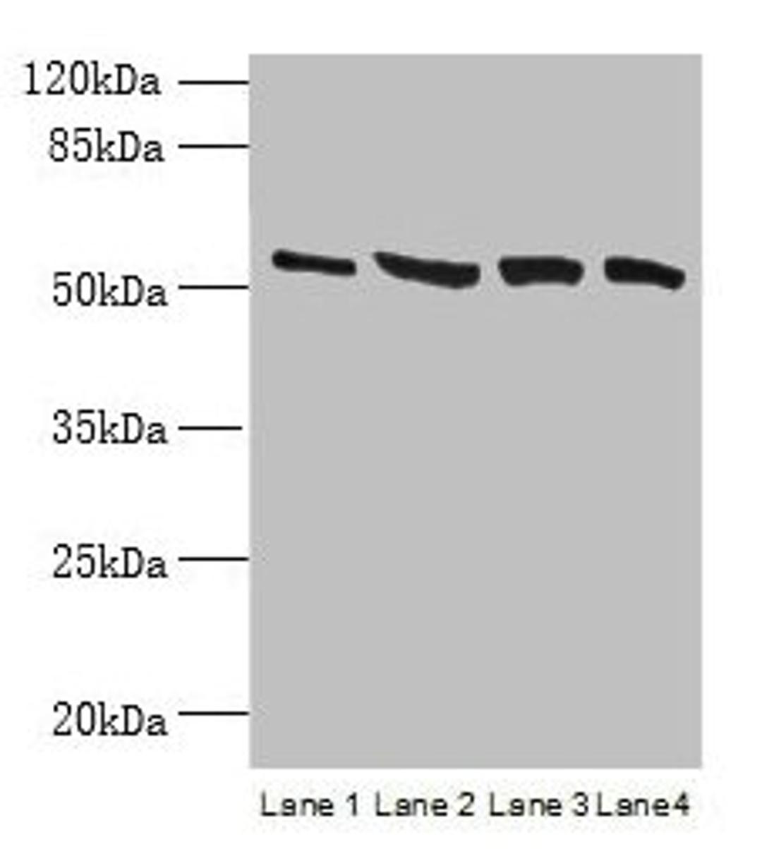 Western blot. All lanes: CCDC112 antibody at 12µg/ml. Lane 1: Jurkat whole cell lysate. Lane 2: Hela whole cell lysate. Lane 3: HepG2 whole cell lysate. Lane 4: A549 whole cell lysate. Secondary. Goat polyclonal to rabbit IgG at 1/10000 dilution. Predicted band size: 54, 62 kDa. Observed band size: 54 kDa