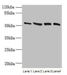 Western blot. All lanes: CCDC112 antibody at 12µg/ml. Lane 1: Jurkat whole cell lysate. Lane 2: Hela whole cell lysate. Lane 3: HepG2 whole cell lysate. Lane 4: A549 whole cell lysate. Secondary. Goat polyclonal to rabbit IgG at 1/10000 dilution. Predicted band size: 54, 62 kDa. Observed band size: 54 kDa