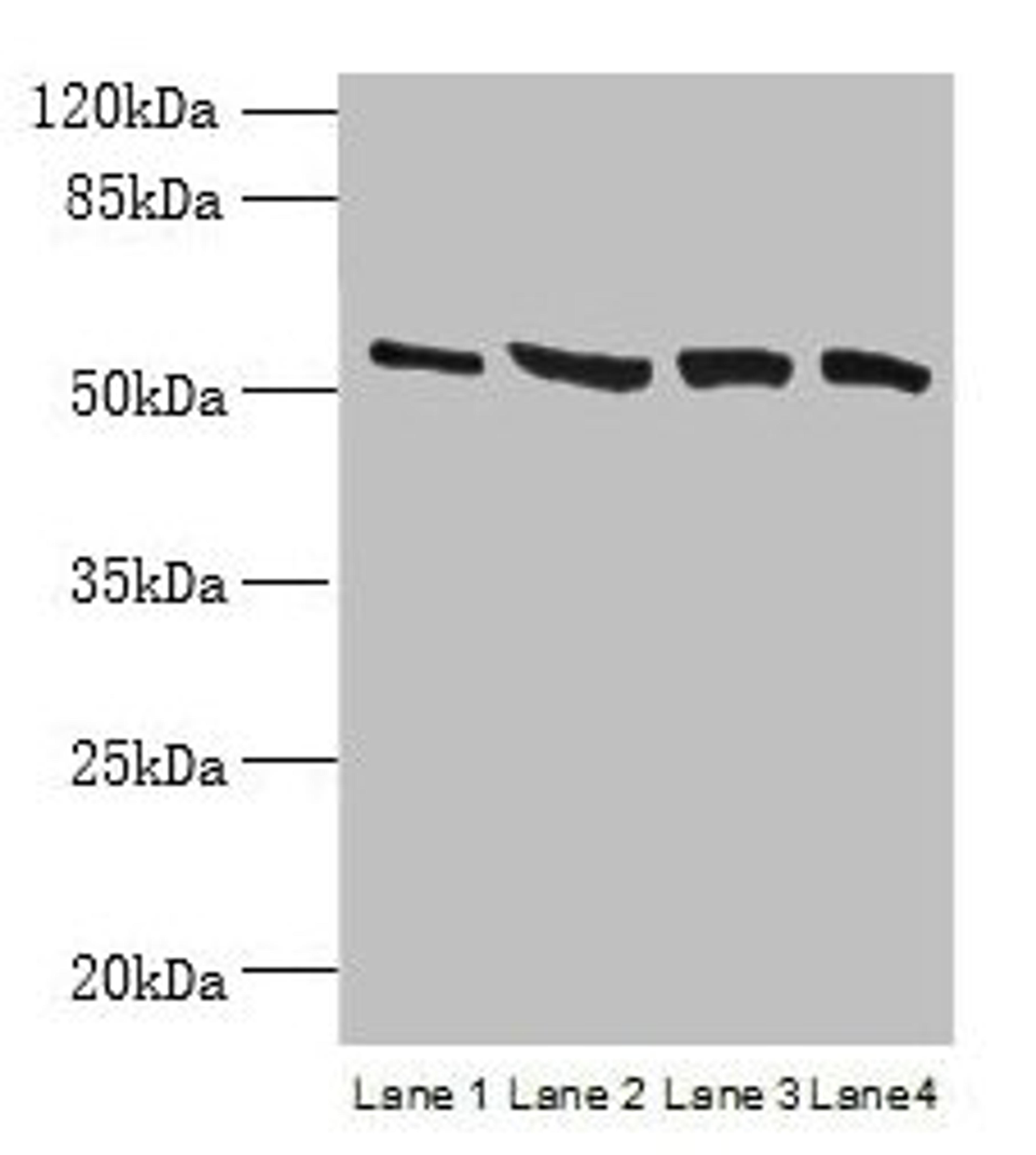 Western blot. All lanes: CCDC112 antibody at 12µg/ml. Lane 1: Jurkat whole cell lysate. Lane 2: Hela whole cell lysate. Lane 3: HepG2 whole cell lysate. Lane 4: A549 whole cell lysate. Secondary. Goat polyclonal to rabbit IgG at 1/10000 dilution. Predicted band size: 54, 62 kDa. Observed band size: 54 kDa