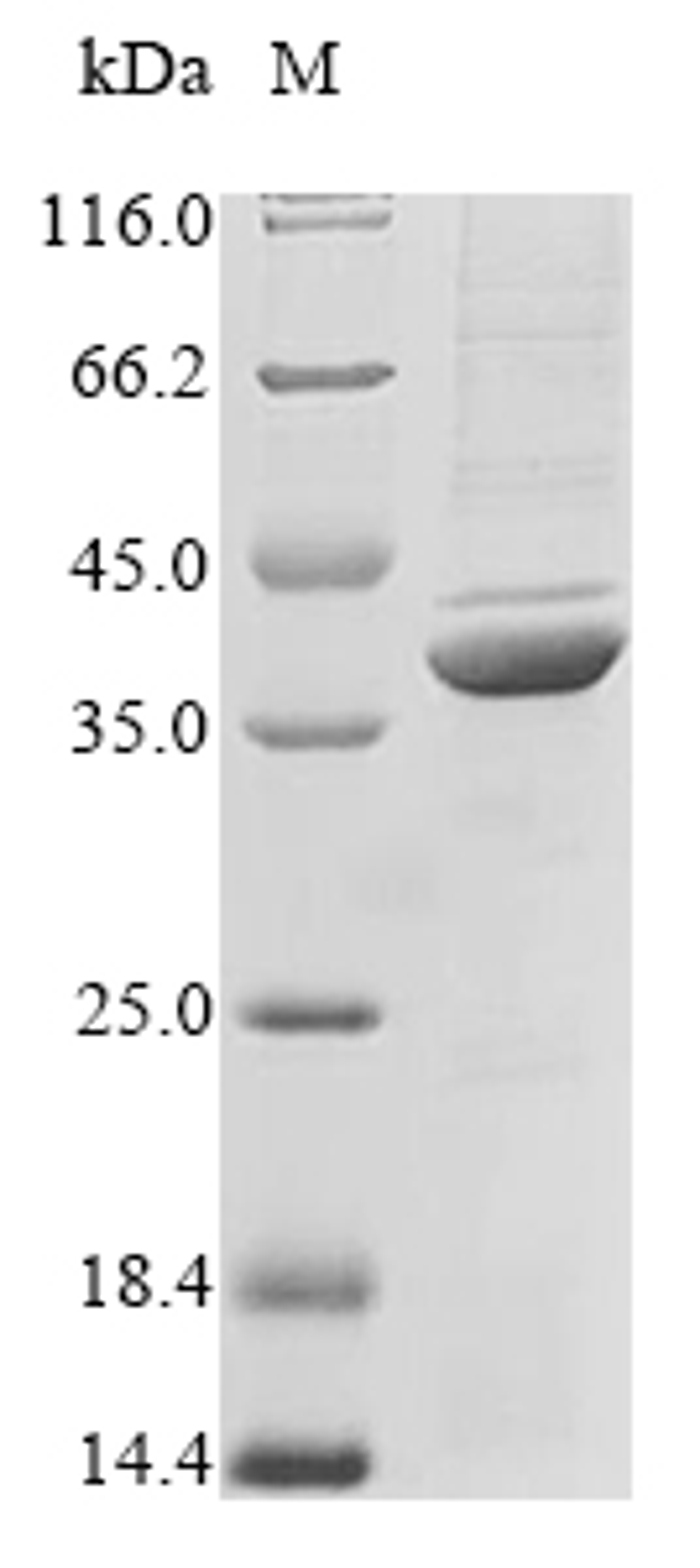 (Tris-Glycine gel) Discontinuous SDS-PAGE (reduced) with 5% enrichment gel and 15% separation gel.