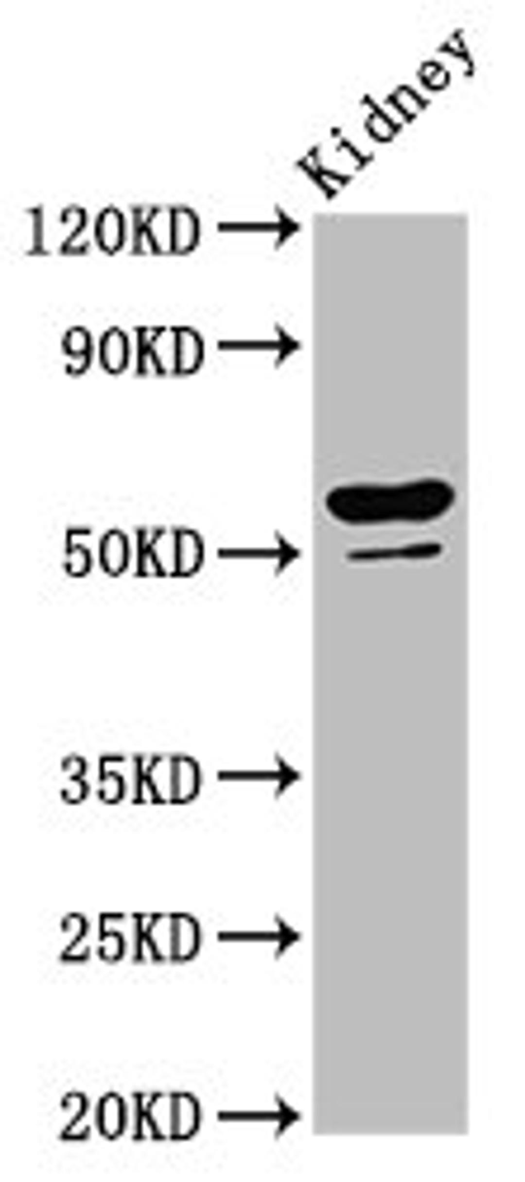 Western Blot. Positive WB detected in: Rat kidney tissue. All lanes: CYP8B1 antibody at 6.4ug/ml. Secondary. Goat polyclonal to rabbit IgG at 1/50000 dilution. Predicted band size: 59 kDa. Observed band size: 59 kDa. 