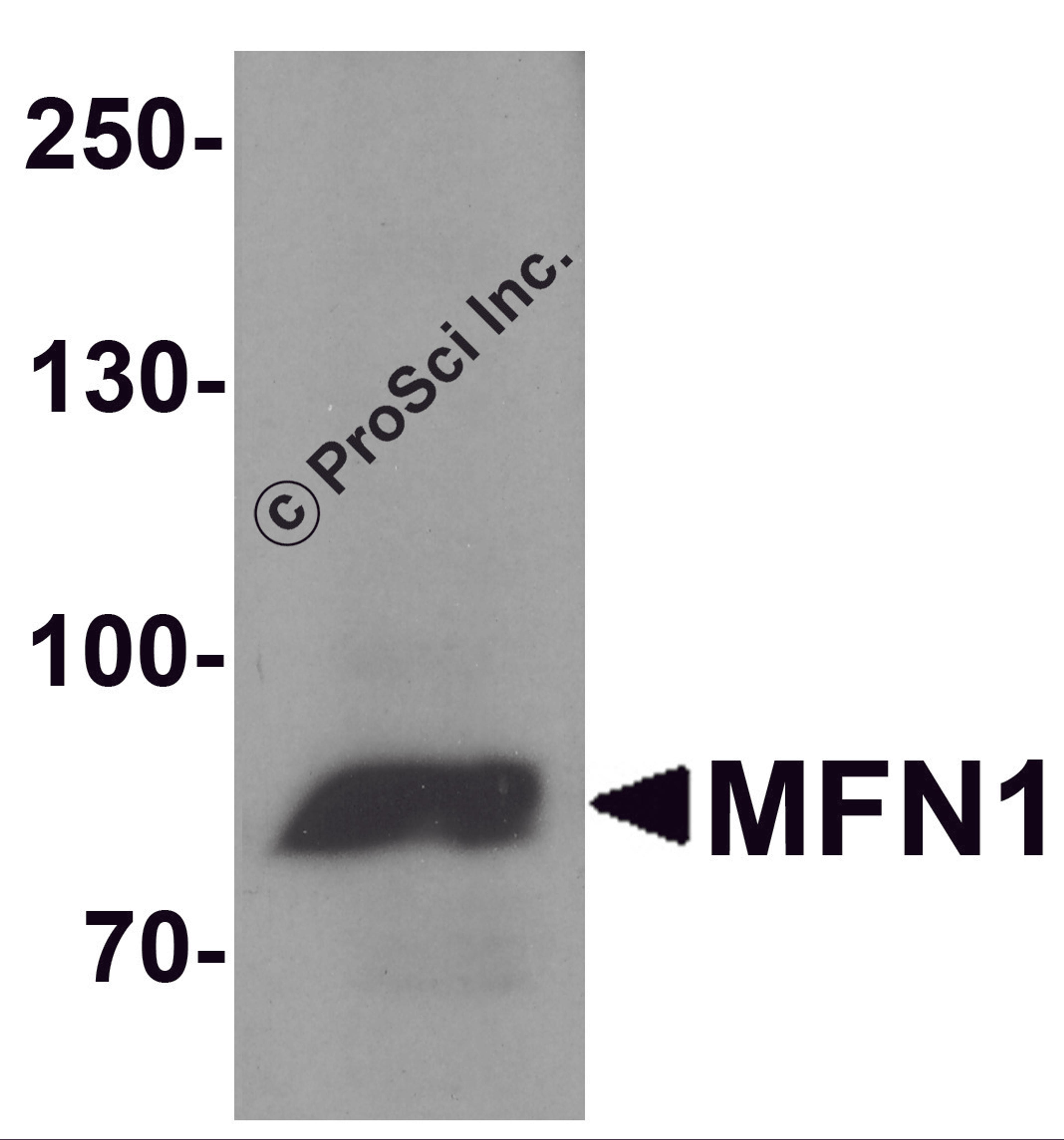 Western blot analysis of MFN1 in A431 cell lysate with MFN1 antibody at 1 &#956;g/ml.