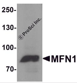 Western blot analysis of MFN1 in A431 cell lysate with MFN1 antibody at 1 μg/ml.